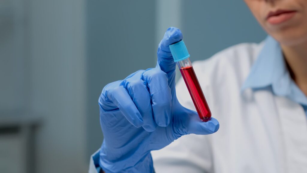 clinica-exame-laboratorio-pichi